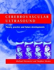 Cerebrovascular Ultrasound "Theory, Practice and Future Developments"
