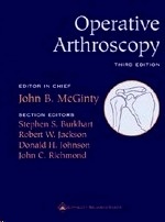 Operative Arthroscopy "Free DVD of surgical procedures"