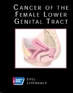 Cancer of The Female Lower Genital Tract