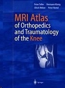 MRI atlas of orthopedics and traumatology of the knee