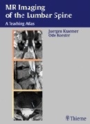 MR-Imaging of the lumbar spine "A teaching atlas"