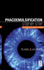 Phacoemulsification: Step by Step "Accompanied by a Video CD Rom"
