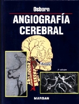 Angiografia Cerebral
