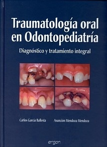 Traumatología Oral en Odontopediatría "Diagnostico y Tratamiento Integral"