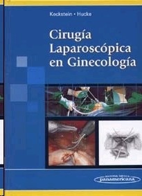 Cirugía Laparoscópica en Ginecología