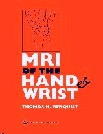 Mri Of Hand And Wrist