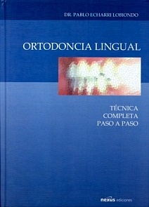 Ortodoncia Lingual "Tecnica Completa Paso a Paso"