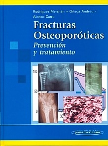 Fracturas Osteoporoticas "Prevencion y Tratamiento"
