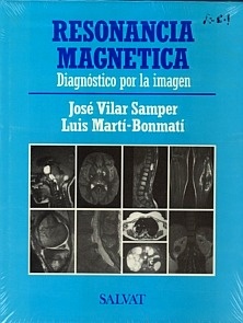 Resonancia Magnética "Diagnóstico por la Imagen"