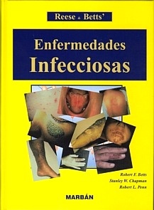 Enfermedades Infecciosas
