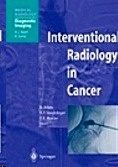 Interventional Radiology In Cancer