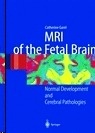 MRI of the Fetal Brain "Normal Development and Cerebral Pathologies"