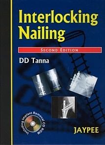 Interlocking Nailing "Incluye Cd Rom"