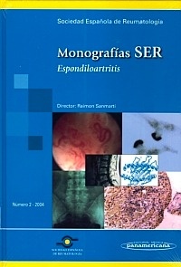 Monografías SER. Espondiloartritis "Número 2-2004"