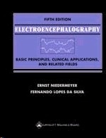 Electroencephalography "Basic Principles, Clinical Applications and Related Fields"