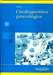 Citodiagnóstico Ginecológico