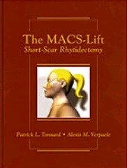 The Macs-lift Short Scar Rhytidectomy
