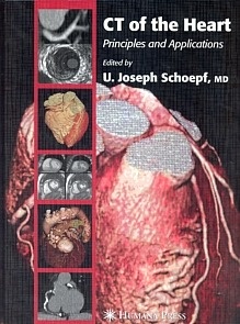 CT of the Heart. "Principles and Applications"
