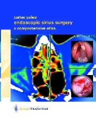 Endoscopic Sinus Surgery "A Comprehensive Atlas"