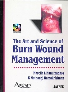 Art & Science of Burn Wound Manage "with photo Cd Rom"