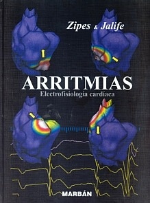 Arritmias "Electrofisiología Cardíaca"