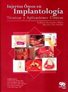 Injertos Oseos en Implantologia "Tecnicas y Aplicaciones Clinicas"