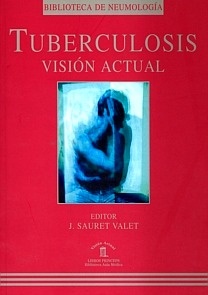 Tuberculosis "Vision Acutal"