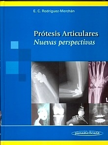 Protesis Articulares "Nuevas Perspectivas"
