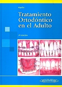 Tratamiento Ortodontico en el Adulto