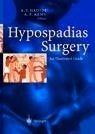 Hypospadias Surgery "An Illustrated Guide"