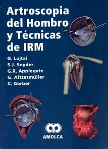 Artroscopia del Hombro y Técnicas de IRM