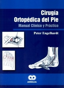 Cirugía ortopédica del pie "Manual clínico y práctico"
