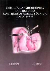Cirugía Laparoscópica del Reflujo Gastroesofágico. Técnica de Nissen "Libro + Cd Rom + 2 Dvd"