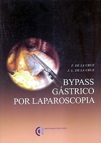 Bypass Gástrico Por Laparoscópia "Incluye Dvd"