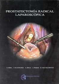 Prostatectomía Radical Laparoscópica "Incluye Dvd"