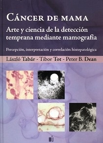 Cancer de Mama "Arte y Ciencia de la Deteccion Temprana Mediante Mamografia"
