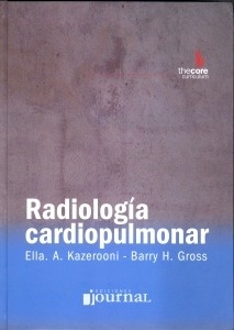 Radiología CardioPulmonar