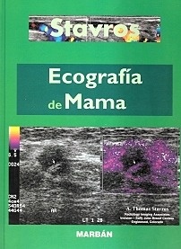 Ecografia de Mama
