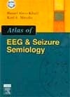 Atlas of EEG  & Seizure semiology
