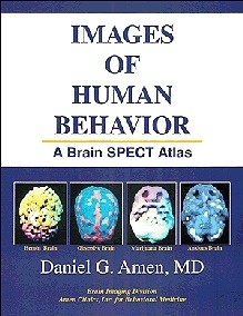 Images of Human Behavior - A Brain SPECT Atlas  Book+CD ROM