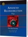 Advance Reconstruction Hip