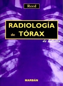Radiologia de Torax "de bolsillo"