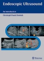Endoscopic Ultrasound "An Introductory Manual and Atlas"