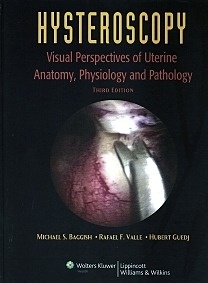 Hysteroscopy "Visual Perspectives Of Uterine Anatomy, Physiology And Pathology"