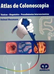 Atlas de Colonoscopia "Técnicas Diagnostico Procedimientos"