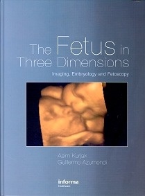 The Fetus In Three Dimensions "Imaging, Embryology & Fetoscopy"