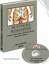 Buttocks Reshaping + DVD "A step-by-step approach to posterior contour surgery inclu....... : a step-by-step approach to posterior contour surgery including thigh and calf implant"