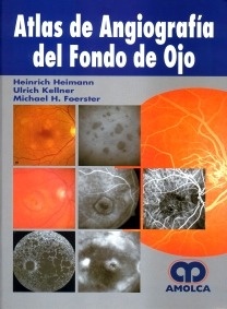 Atlas de angiografía del fondo de ojo