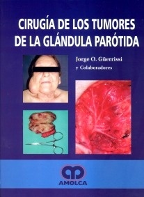 Cirugía de los Tumores de la Glándula Parótida