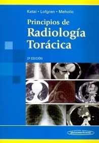 Principios de Radiologia Torácica